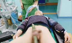 一男子下体被竹子刺穿