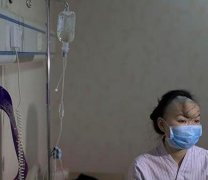 女子被前夫咬掉鼻子 取肋软骨重造鼻