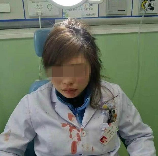 女医生指错路被病人家属打骨折？警方：已介入调查