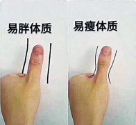 大拇指形状决定你易瘦还是易胖？假的