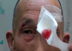 男子被人打出血  对方以为他要来抢东西