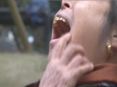 女子去拔牙   想拔掉的牙齿还在不想拔的不见了