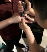 结婚钻戒刚戴上 取不下来无奈剪断