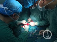 35周婴儿因肠梗阻早产 医生挤出80多公分胎粪